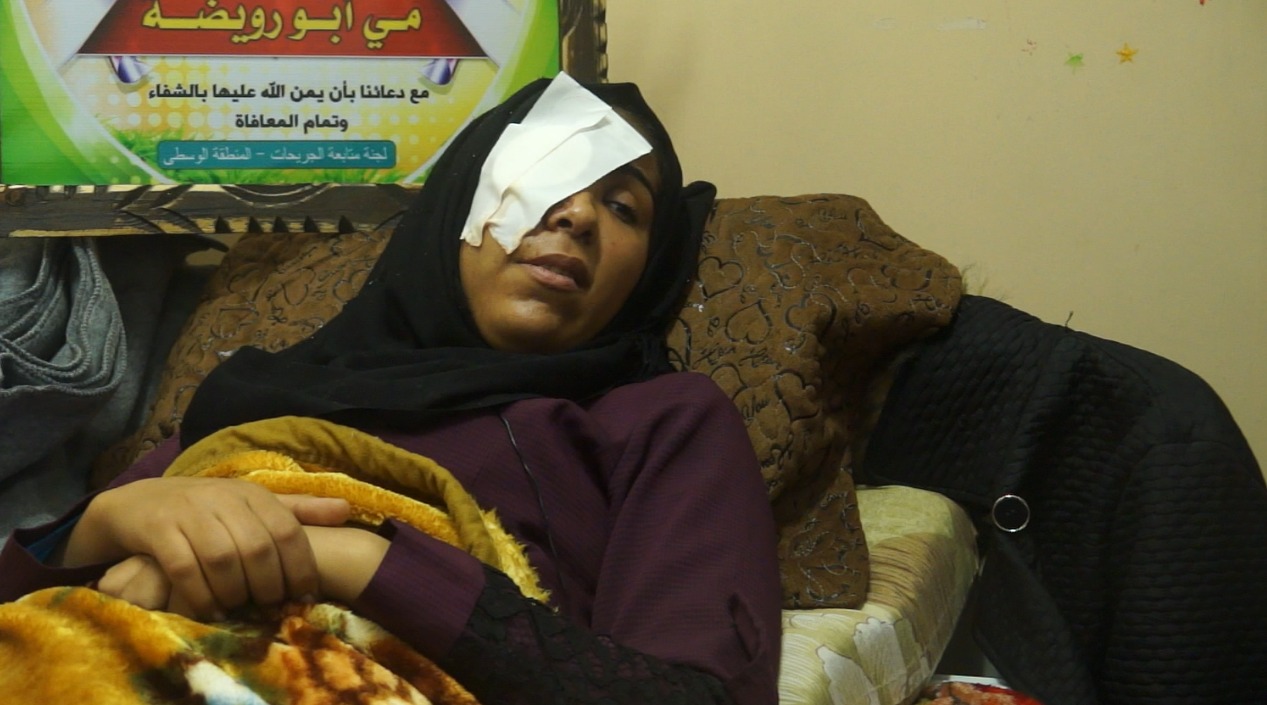 صوت| رصاصة إسرائيلية تفقد "مي أبو رويضة" عينها اليمنى